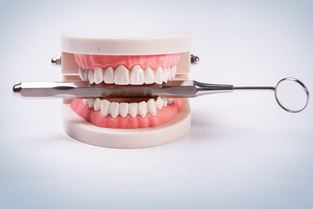 the ultimate guide to choosing the right type of dental implant